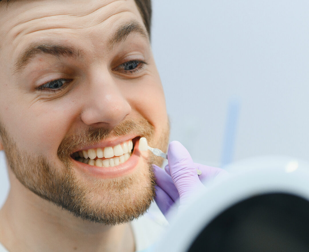 Veneers vs. Crowns: Which is Right for You?