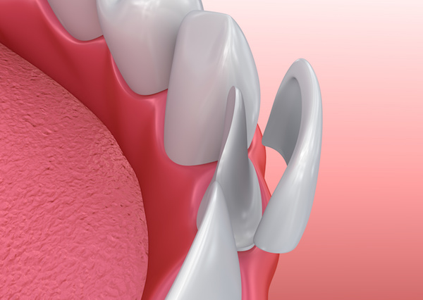 Biocompatible ceramic and composite dental restoration materials